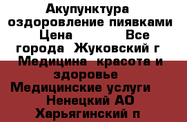 Акупунктура, оздоровление пиявками › Цена ­ 3 000 - Все города, Жуковский г. Медицина, красота и здоровье » Медицинские услуги   . Ненецкий АО,Харьягинский п.